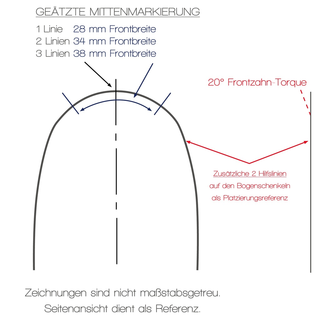 FLEXADENT NiTi SE Pre-Torqued